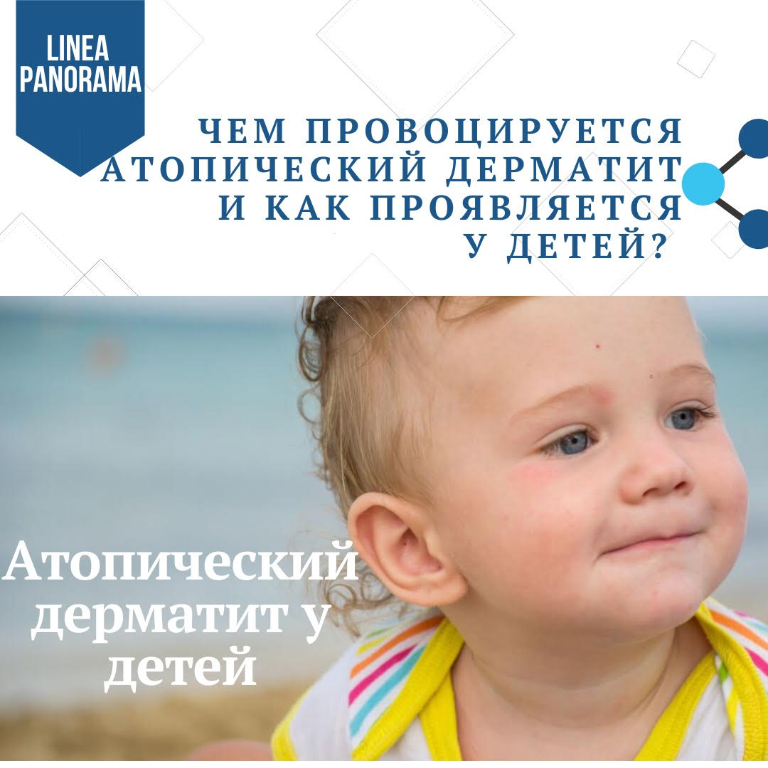 Чем провоцируется атопический дерматит у детей?