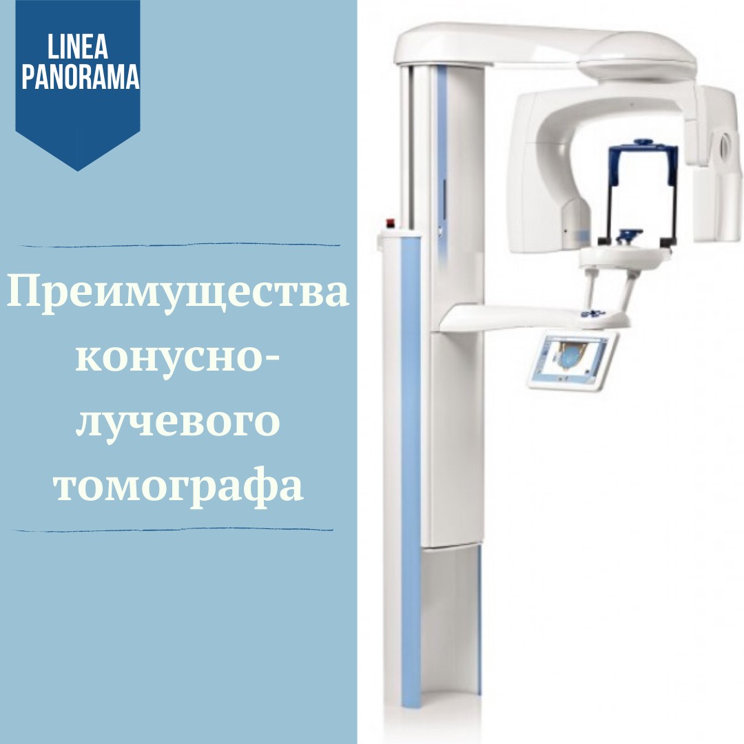 Преимущества конусно-лучевого томогафа