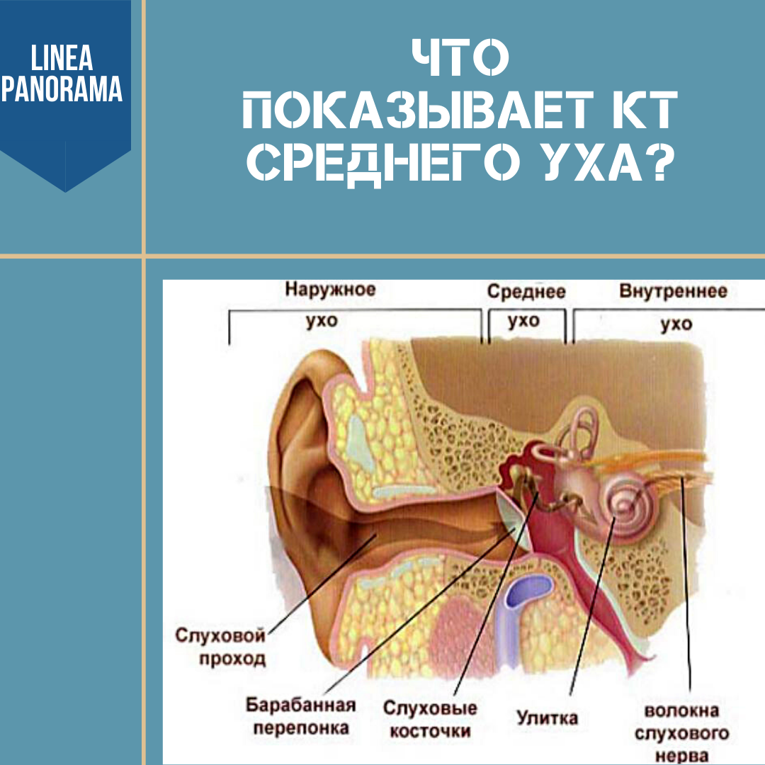 Что показывает КТ среднего уха?